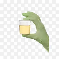 戴着绿色手套拿着尿液