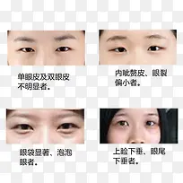 整形美容眼部实物图展示