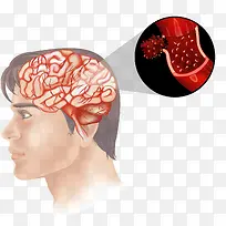 人类大脑血管分析图