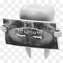 牙齿X光透视片