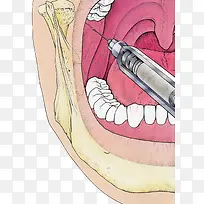 口腔卫生医疗插图
