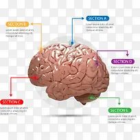 塑料大脑信息图表