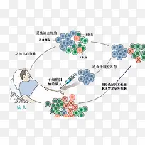 干细胞移植技术