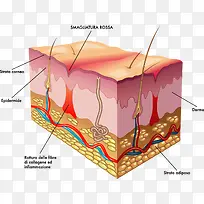 人体皮肤结构分析图