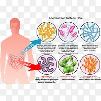 人体肠道好坏细菌分析