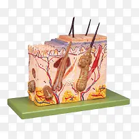 皮肤粉刺细胞效果模型图