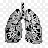 卡通吸烟肺部