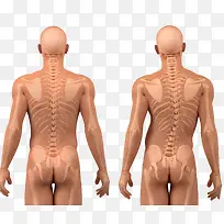 腰椎畸形对比图