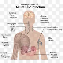 HIV 艾滋病 PNG