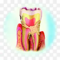 蛀牙牙科展板图片