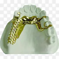 镶牙牙科展板图片