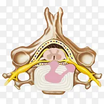 腰椎管突出疼痛撕裂